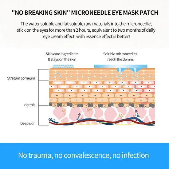 Dissolvable Microneedle Eye Patch